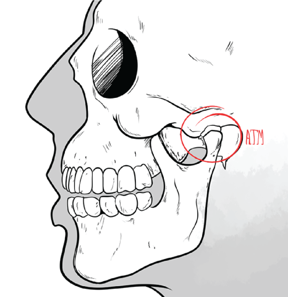 A black and white illustration depicts a person in profile, showing only their silhouette. The focus is on the skull, which is detailed and clearly visible. Over the person's temporomandibular joint (TMJ), there is a red circle indicating the location.